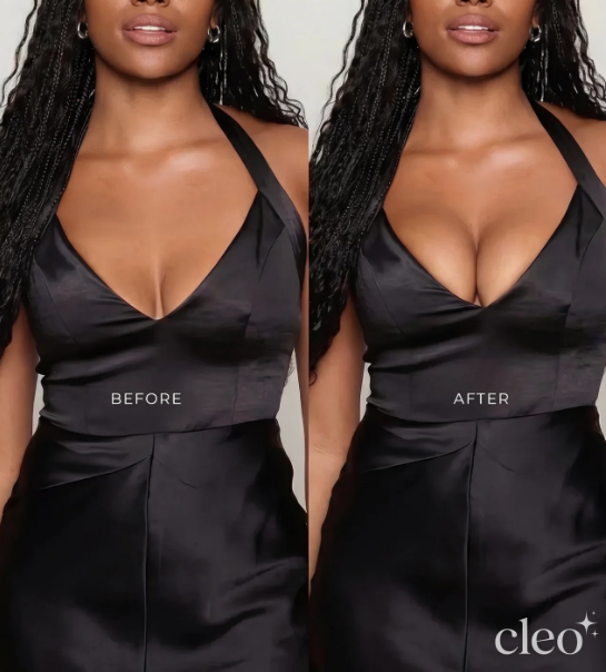 Cleo Invisible Lift Inserts — Instant 2-Cup Boost